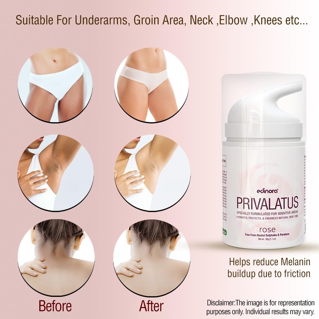 EDINORA PRIVALATUS ROSE CREAM (50g)