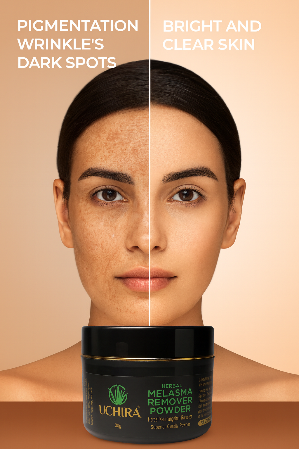 Uchira pigmentation remove herbal powder.